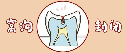预防儿童龋齿最常见的方法为